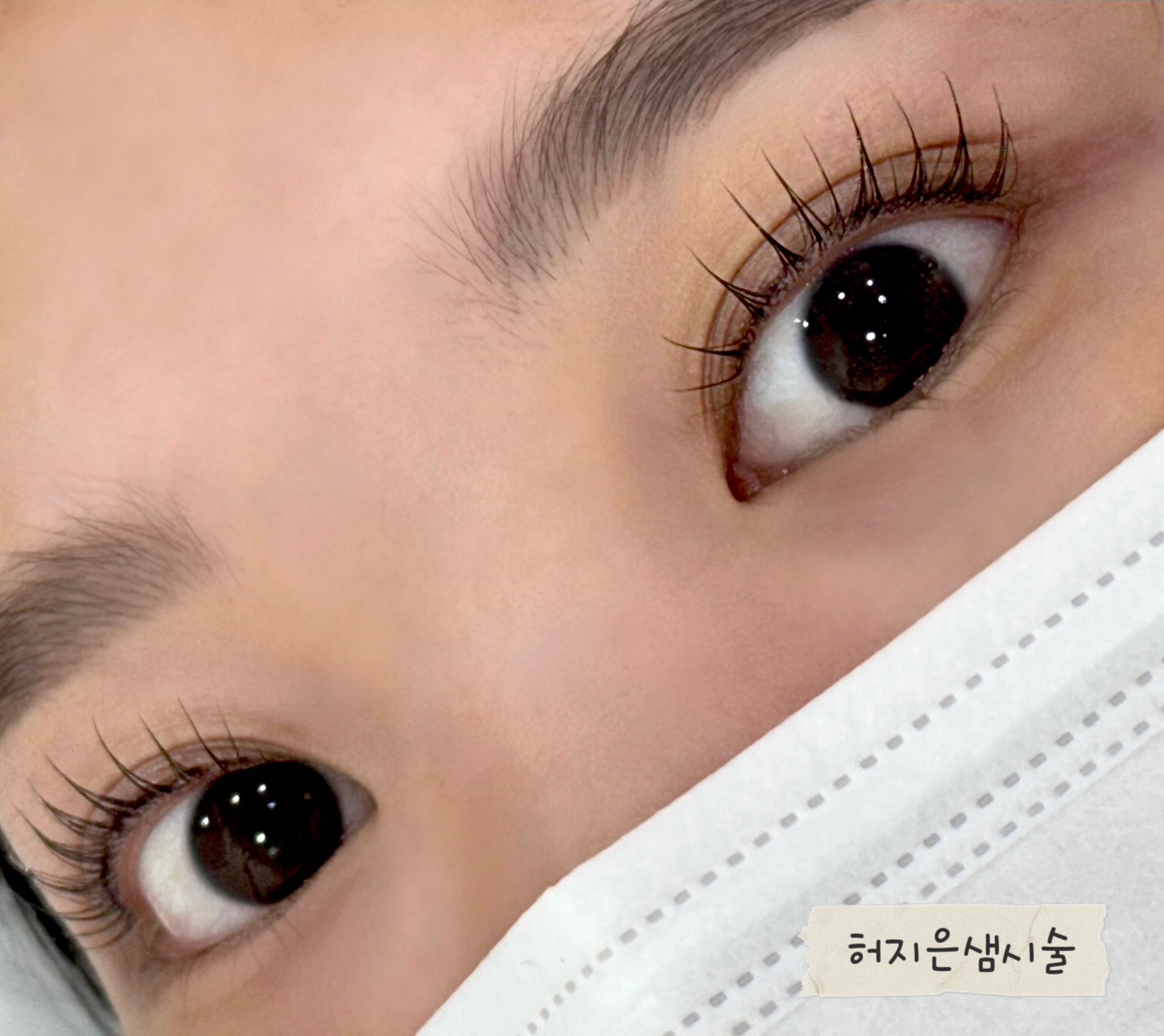레드아이