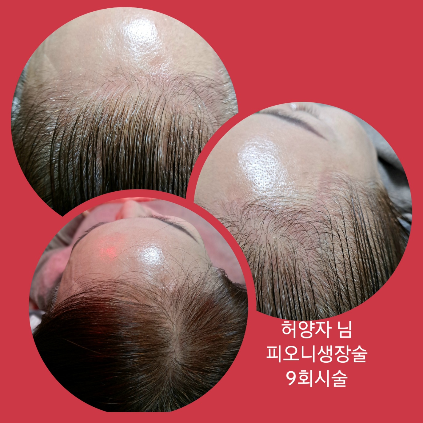 희헤어사랑