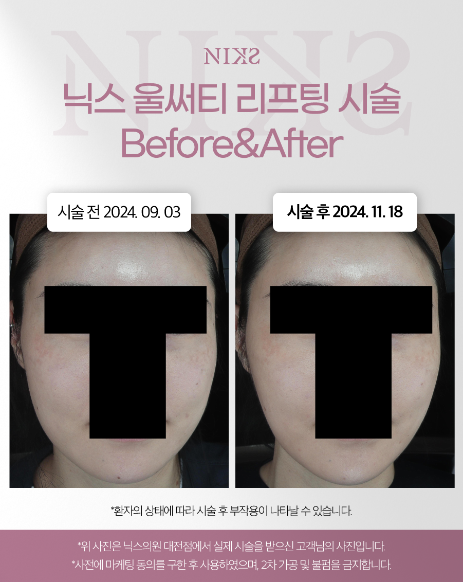 닉스의원 대전 대표 이미지