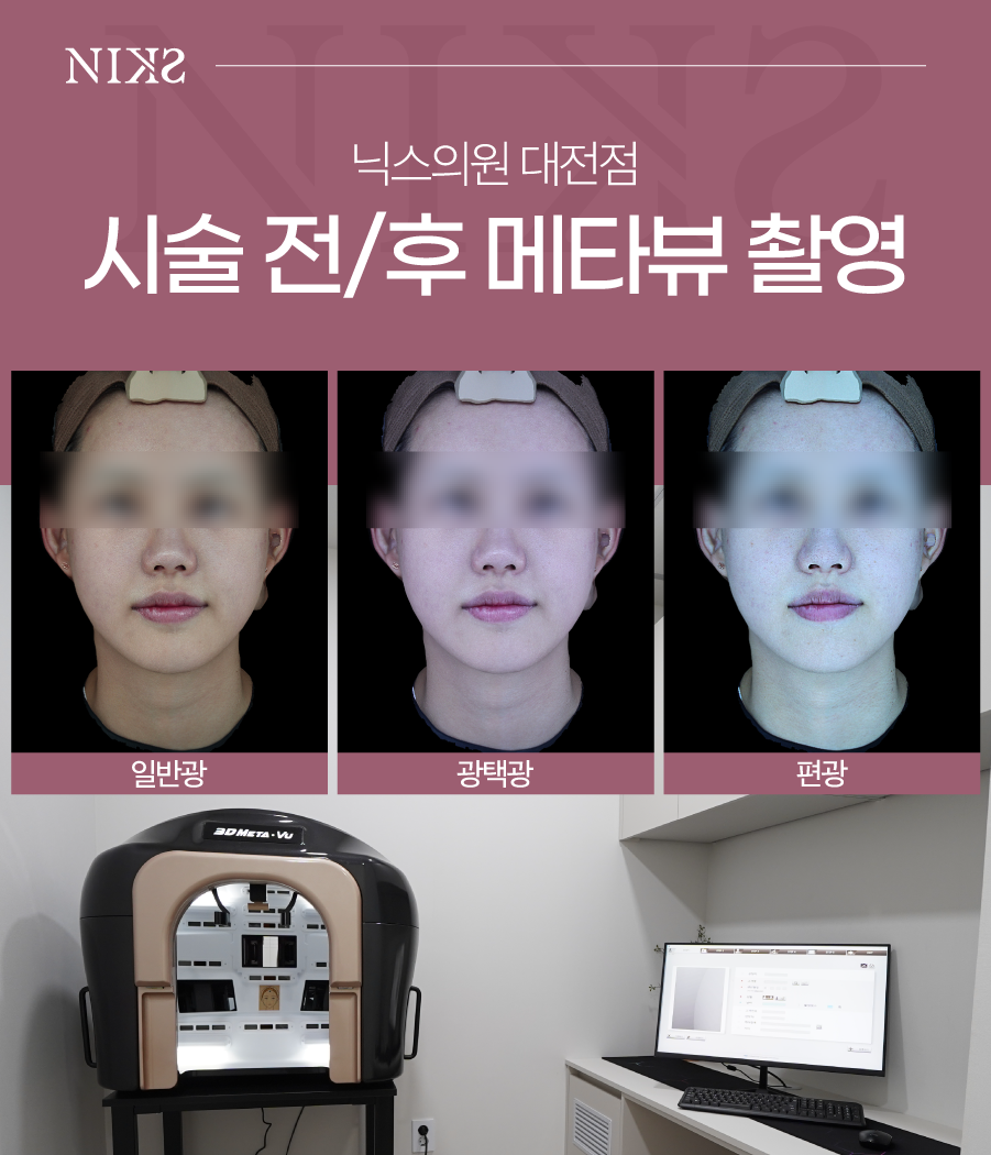 닉스의원 대전 대표 이미지