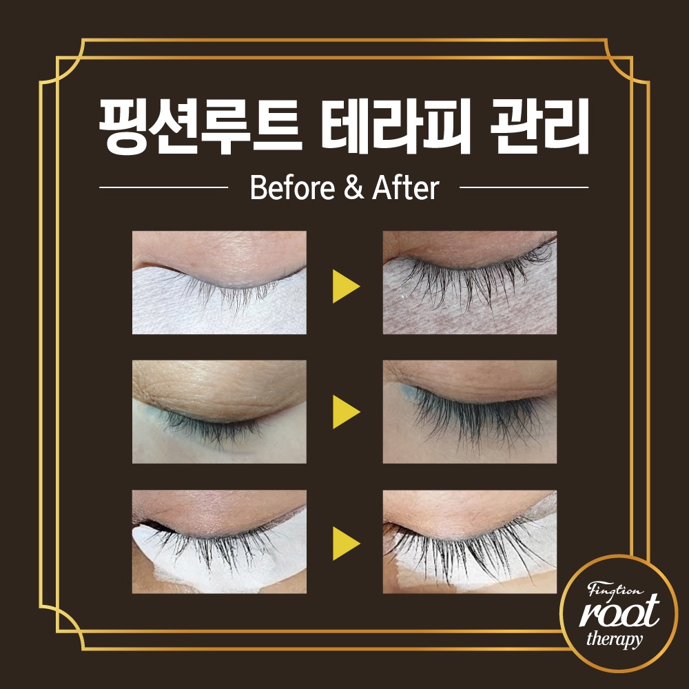 유어아띠