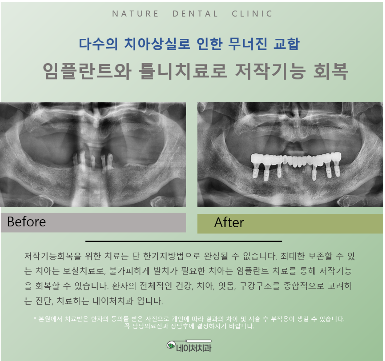 네이처치과의원 대표 이미지