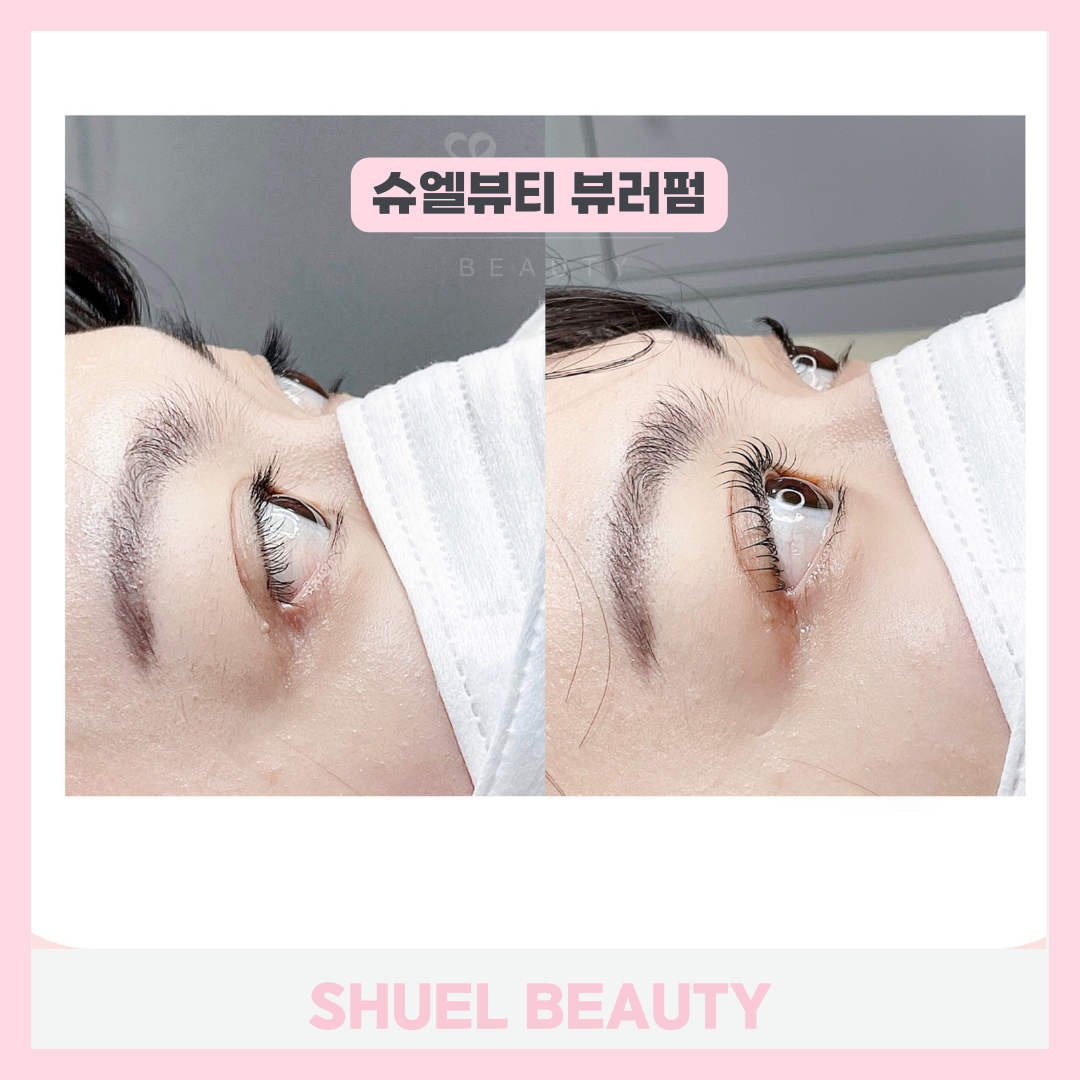 슈엘뷰티