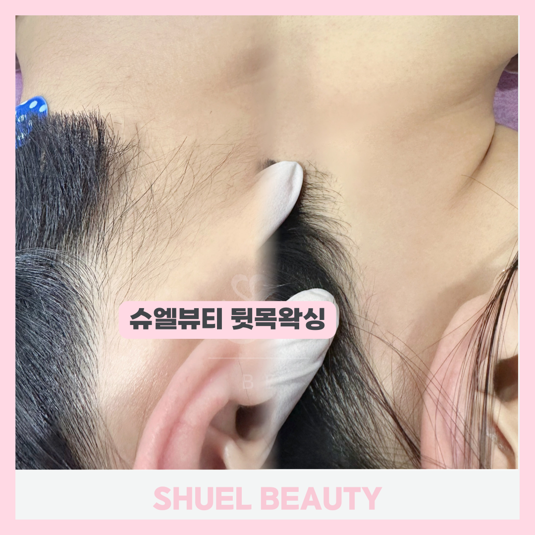 슈엘뷰티