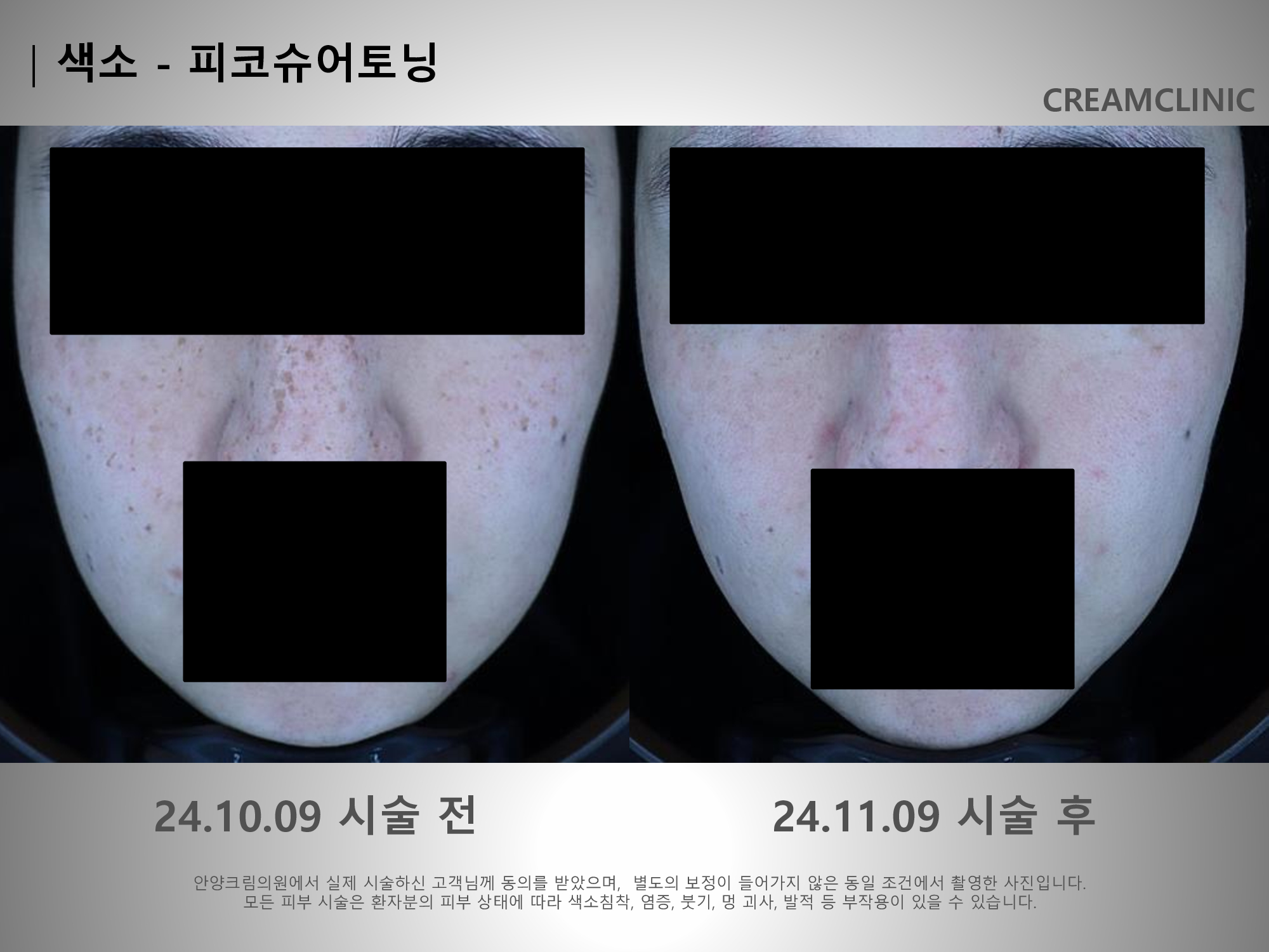 크림의원 안양범계역 대표 이미지