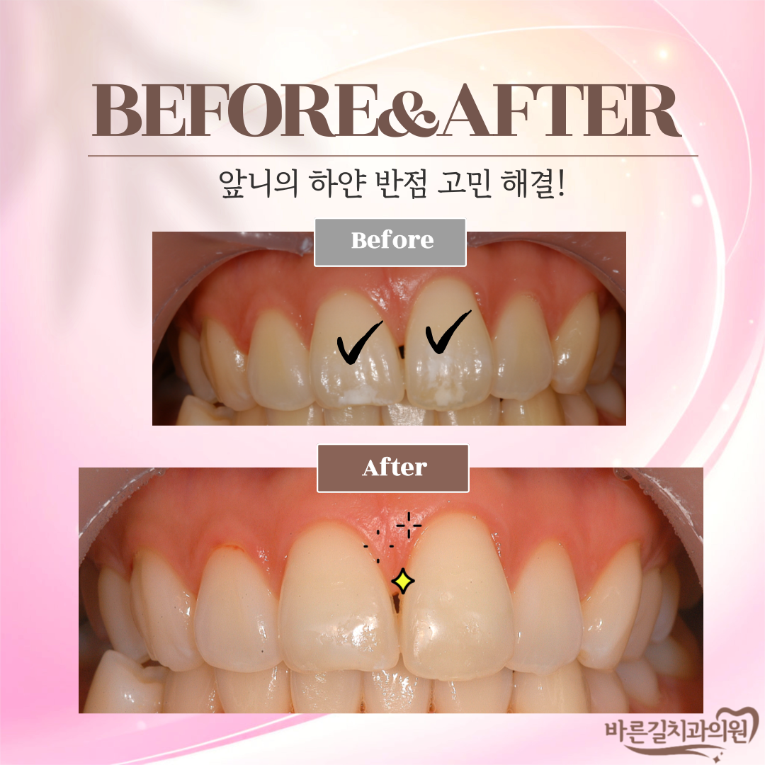 바른길치과의원 대전 대표 이미지