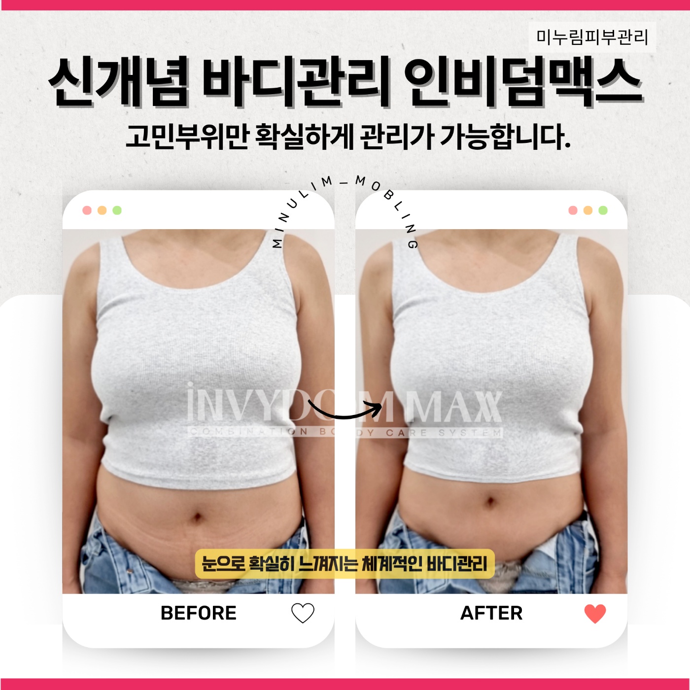 미누림 체형관리 바디슬리밍