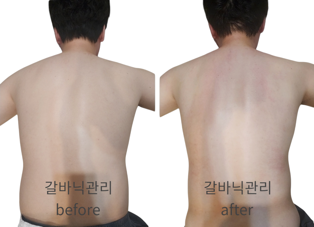 쑴숨쉬듯휴식하다&숲칼프