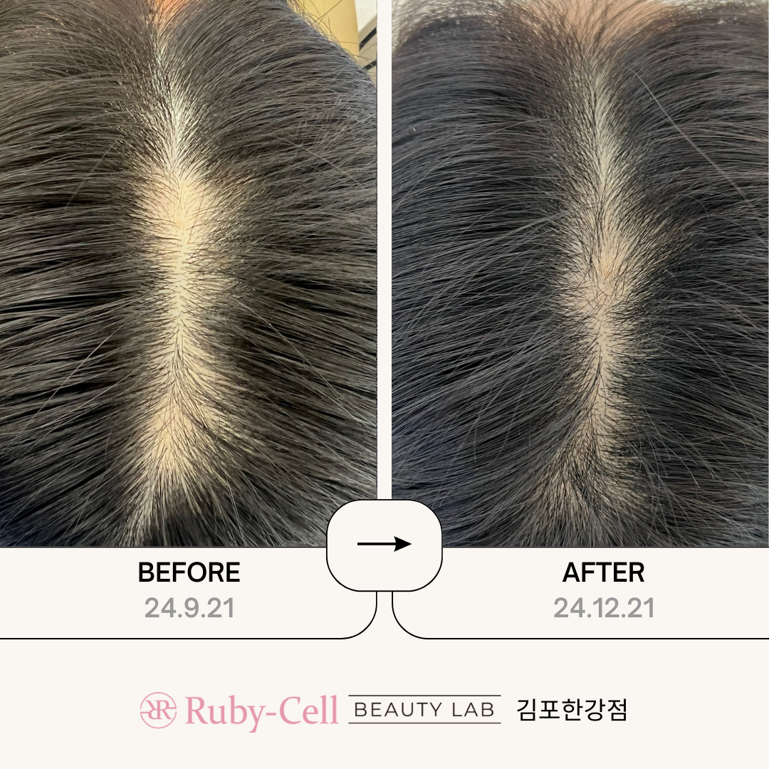 루비셀뷰티랩 김포한강점