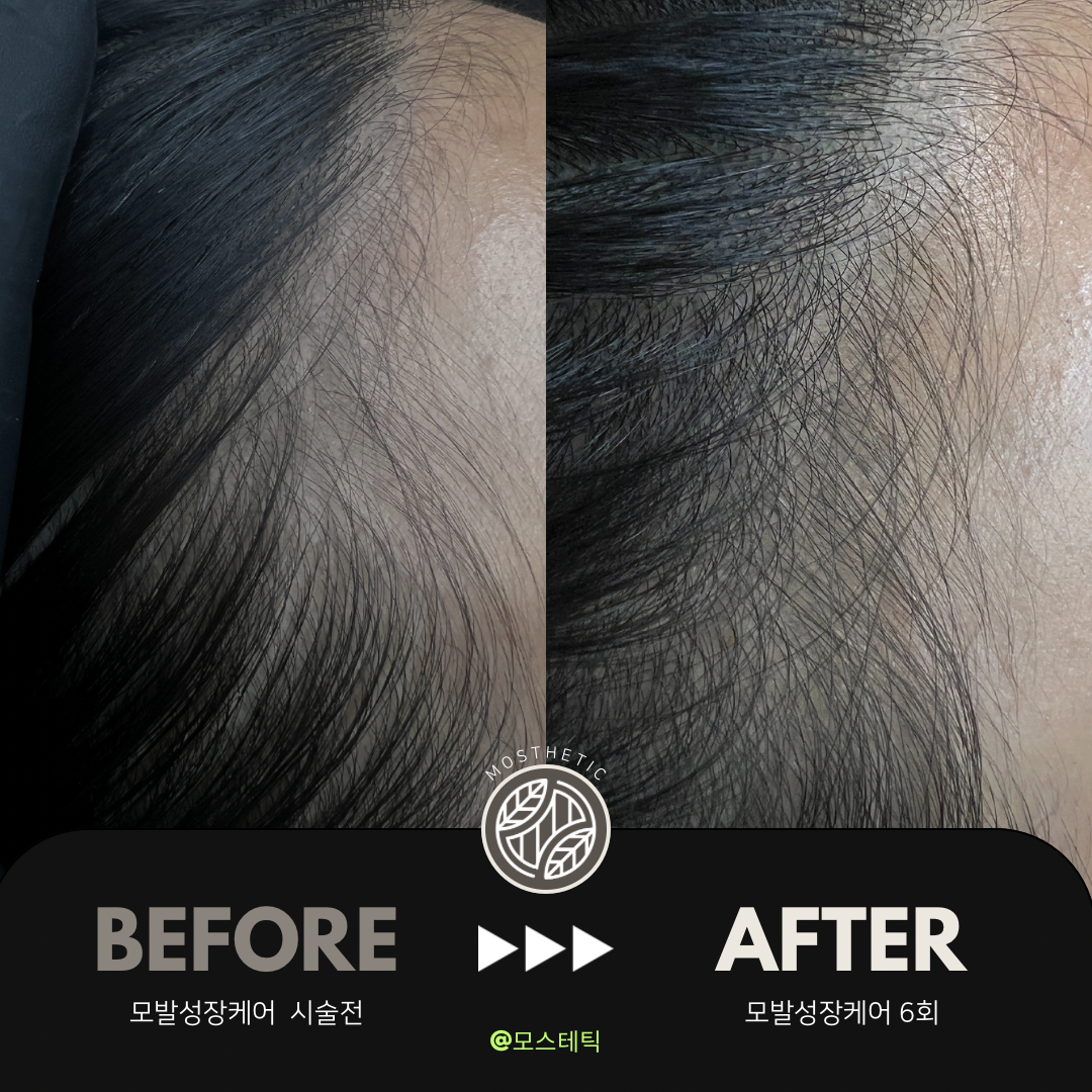 모스테틱 천안 불당점 대표 이미지