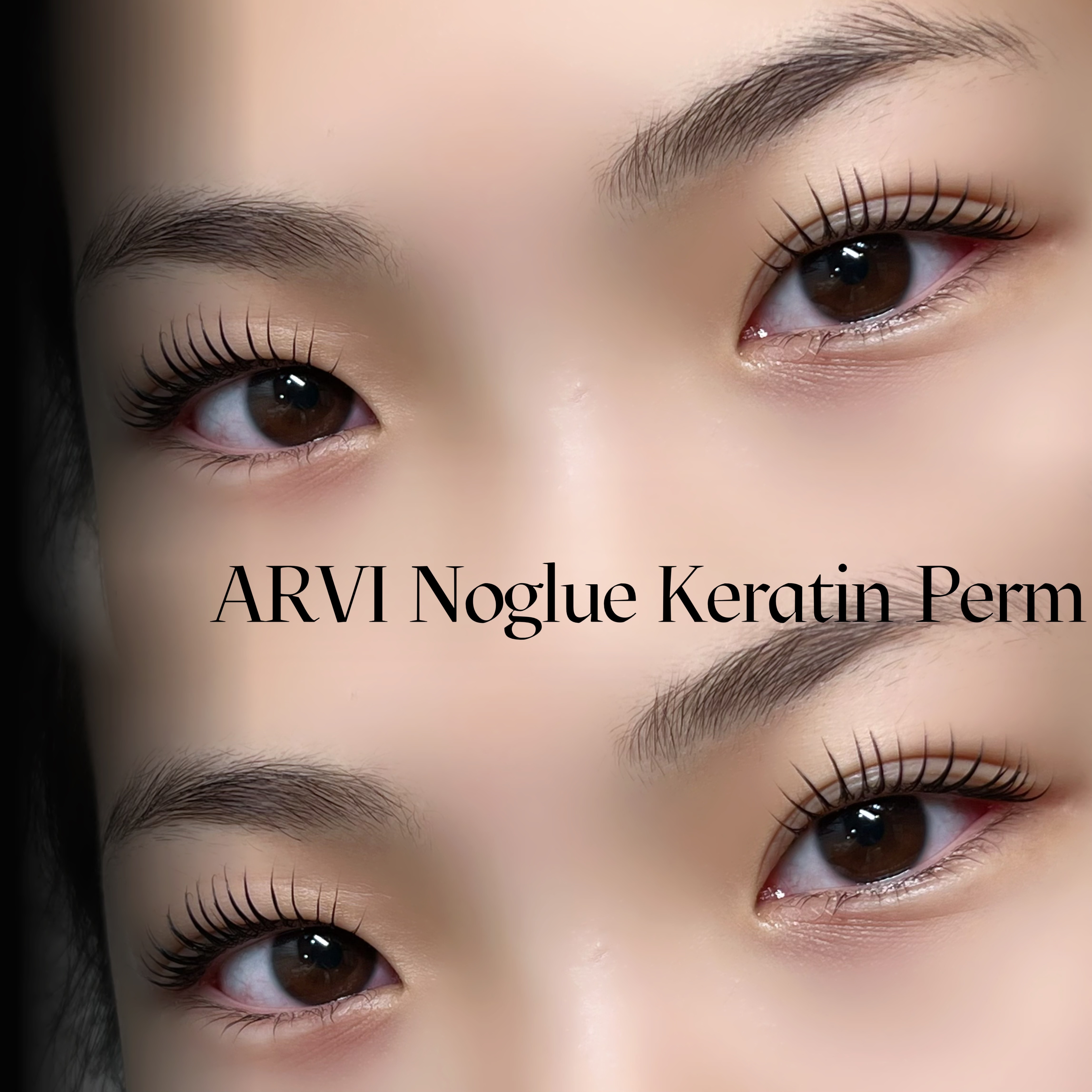 아르비 대표 이미지