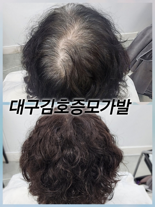 슈앤모 증모 가발