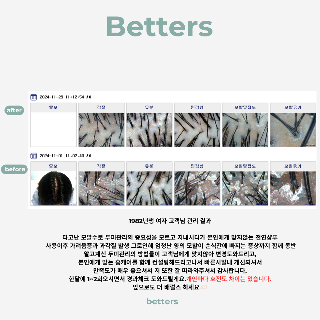 배럴스두피탈모센터 대표 이미지