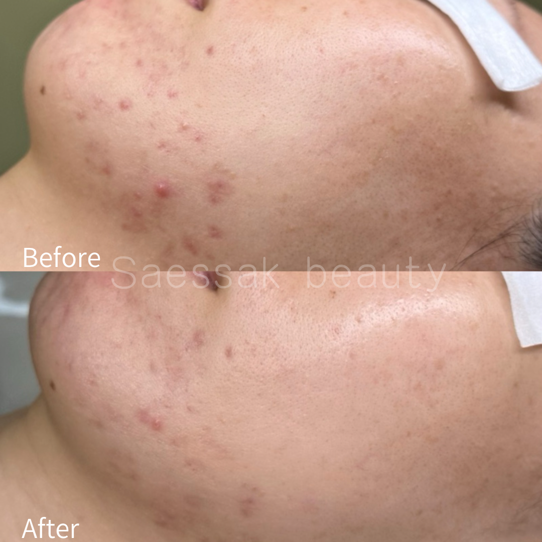 새싹뷰티 대표 이미지