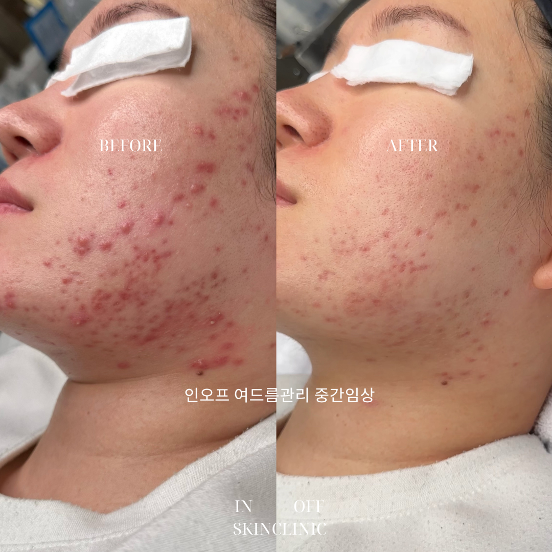 인오프 대표 이미지