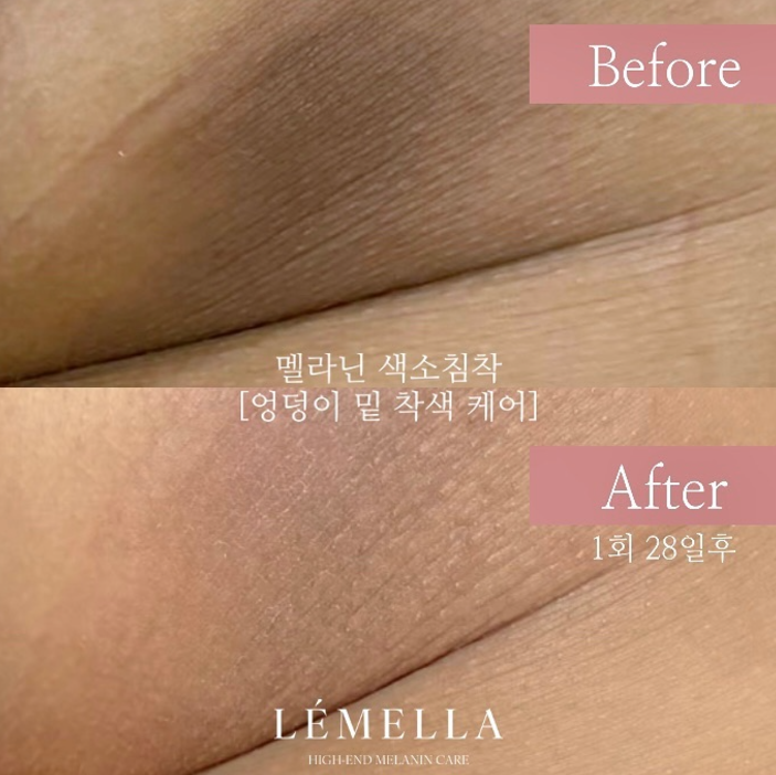 이뽐뷰티 배곧본점