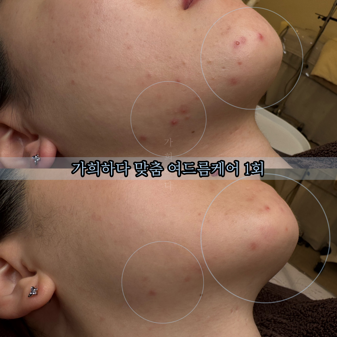 가희하다 잠실 대표 이미지
