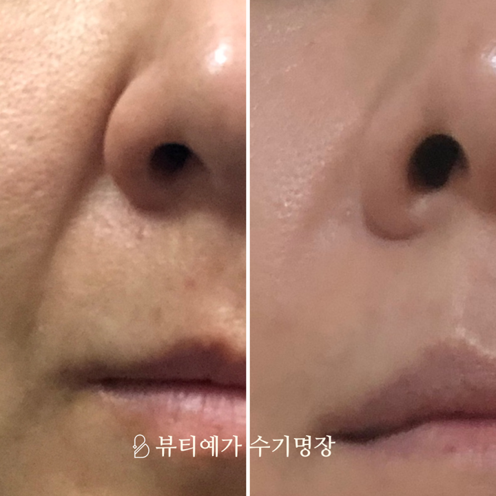 뷰티예가 수기명장 부산동래사직본점 photo 6