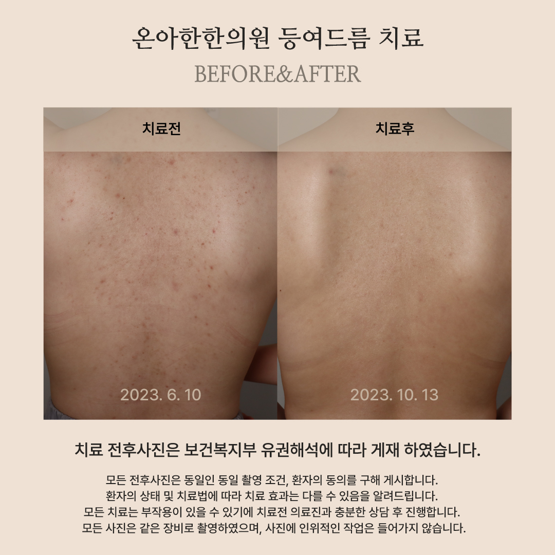 온아한한의원 잠실 대표 이미지