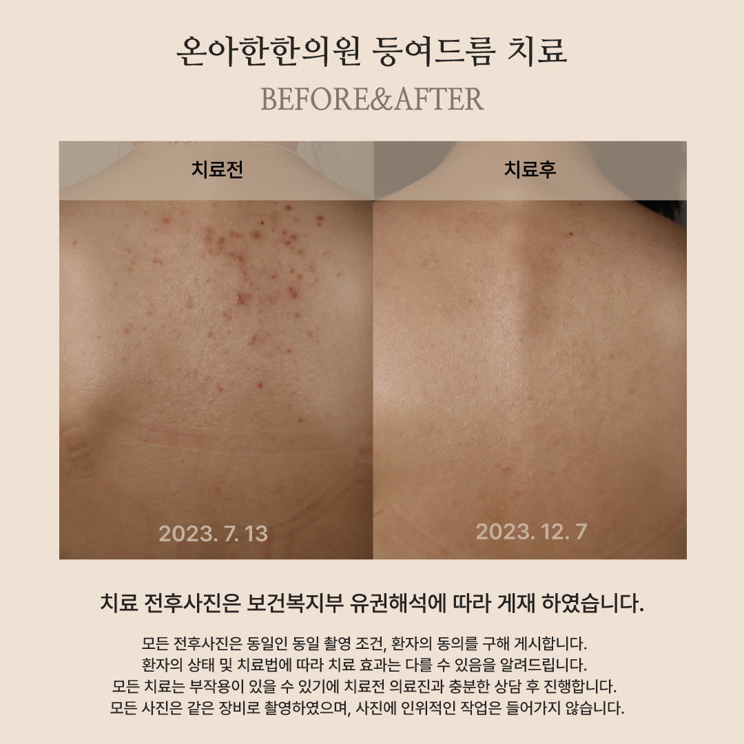 온아한한의원 잠실 대표 이미지