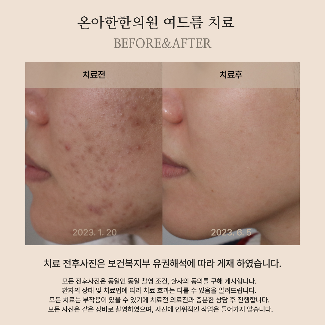 온아한한의원 잠실 대표 이미지