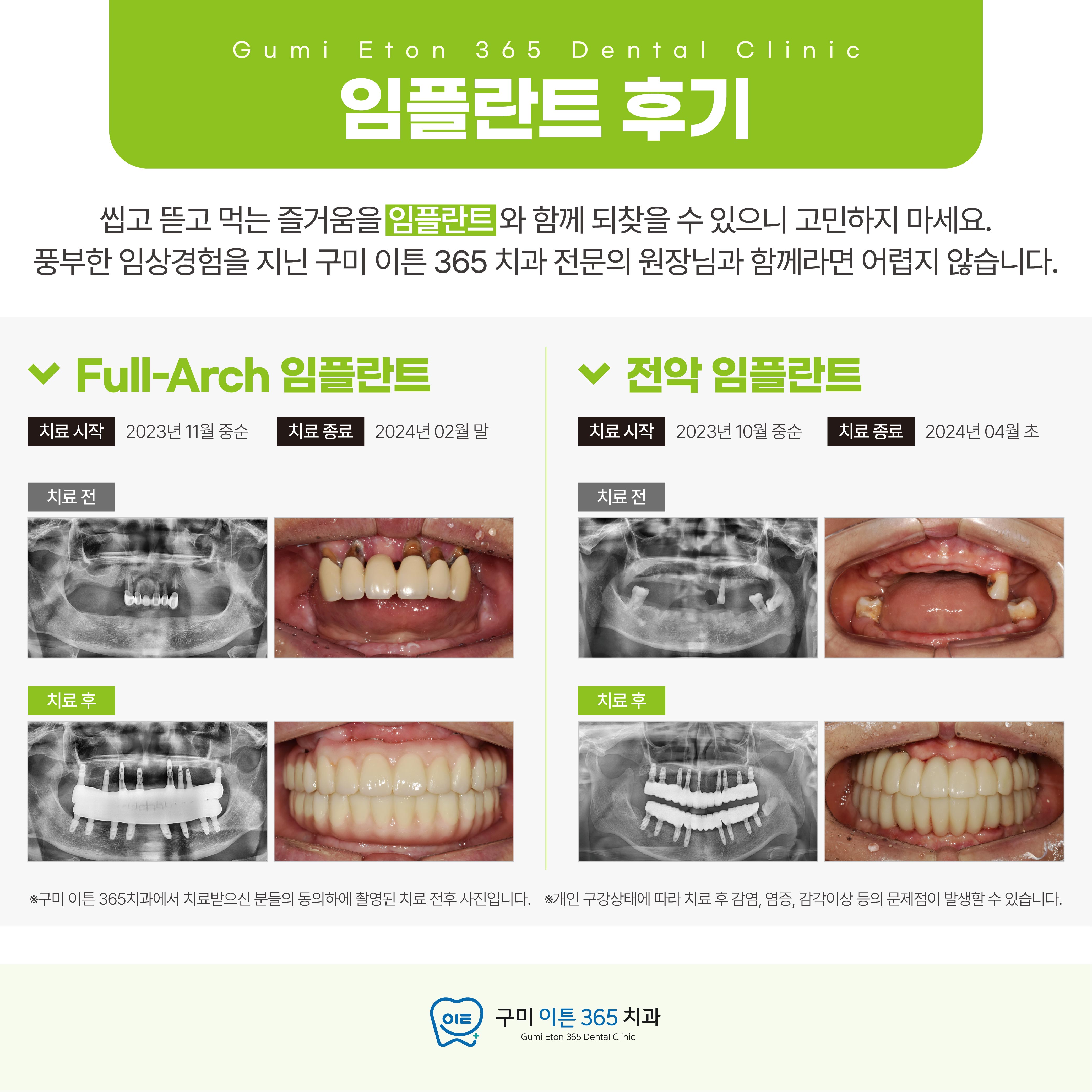 구미이튼365치과의원 대표 이미지