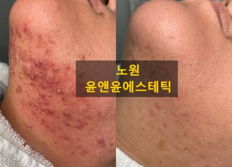 윤앤윤 에스테틱 대표 이미지