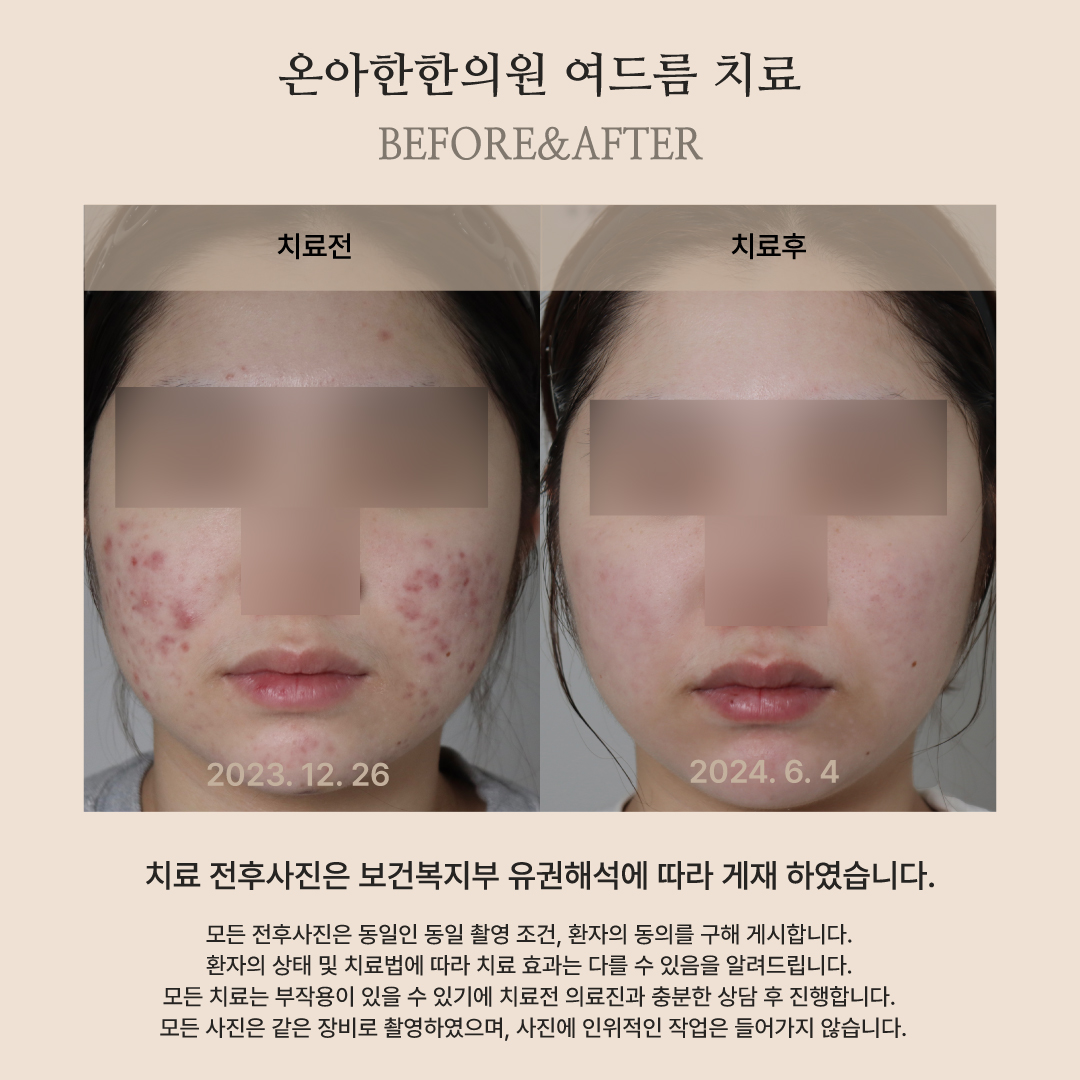 온아한한의원 잠실 대표 이미지