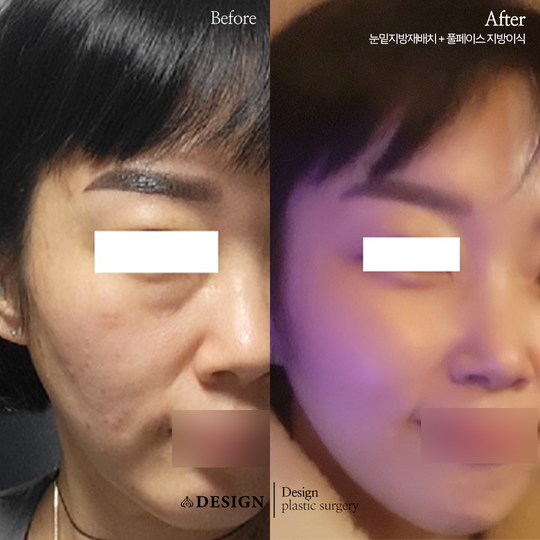 디자인성형외과의원 부산서면역 대표 이미지