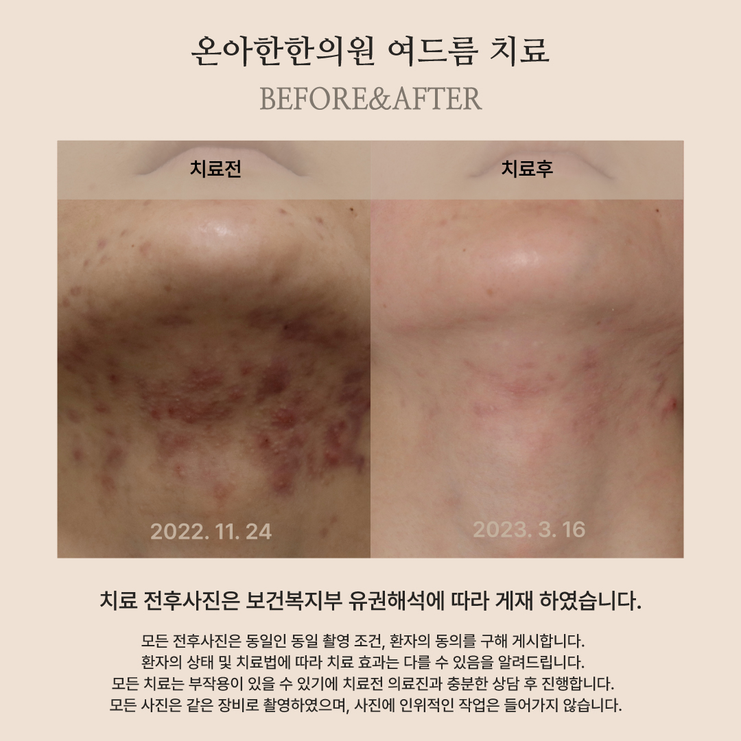 온아한한의원 잠실 대표 이미지