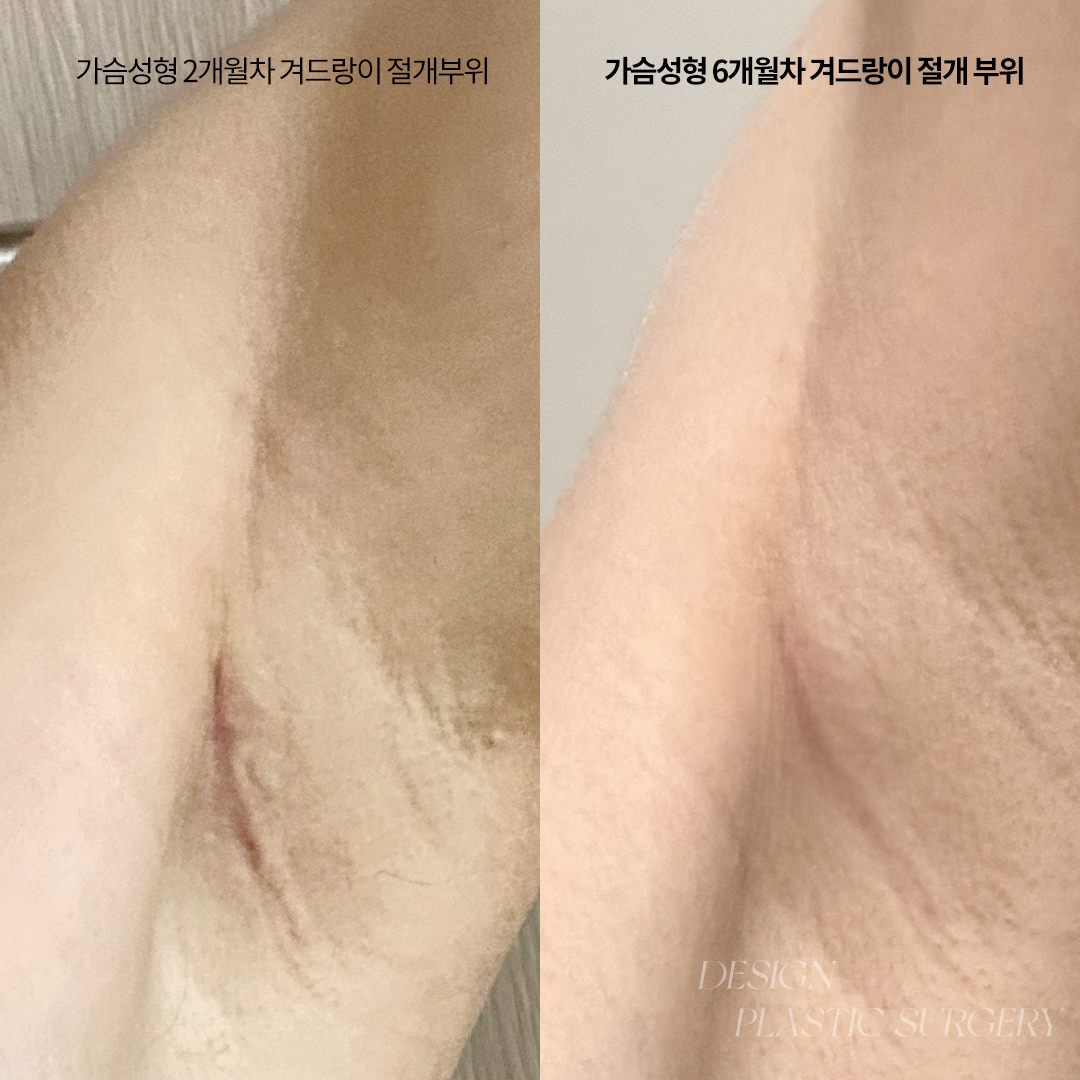 디자인성형외과의원 부산서면역 대표 이미지