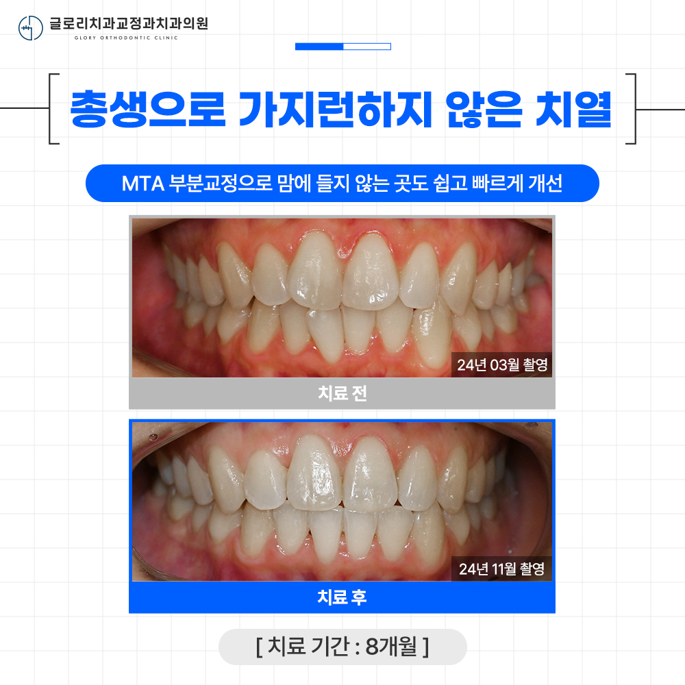 글로리치과교정과치과의원 대표 이미지