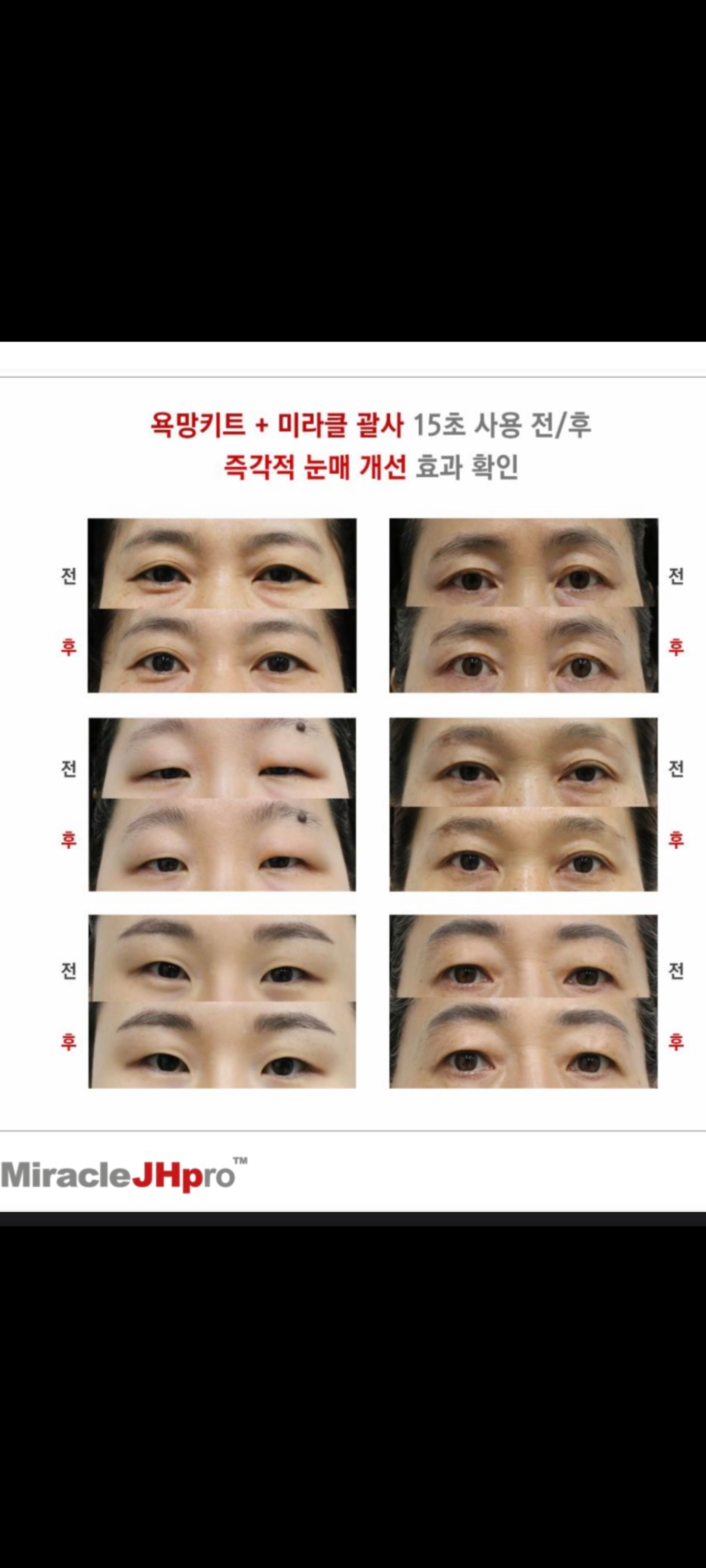 에스뜨레야 대표 이미지