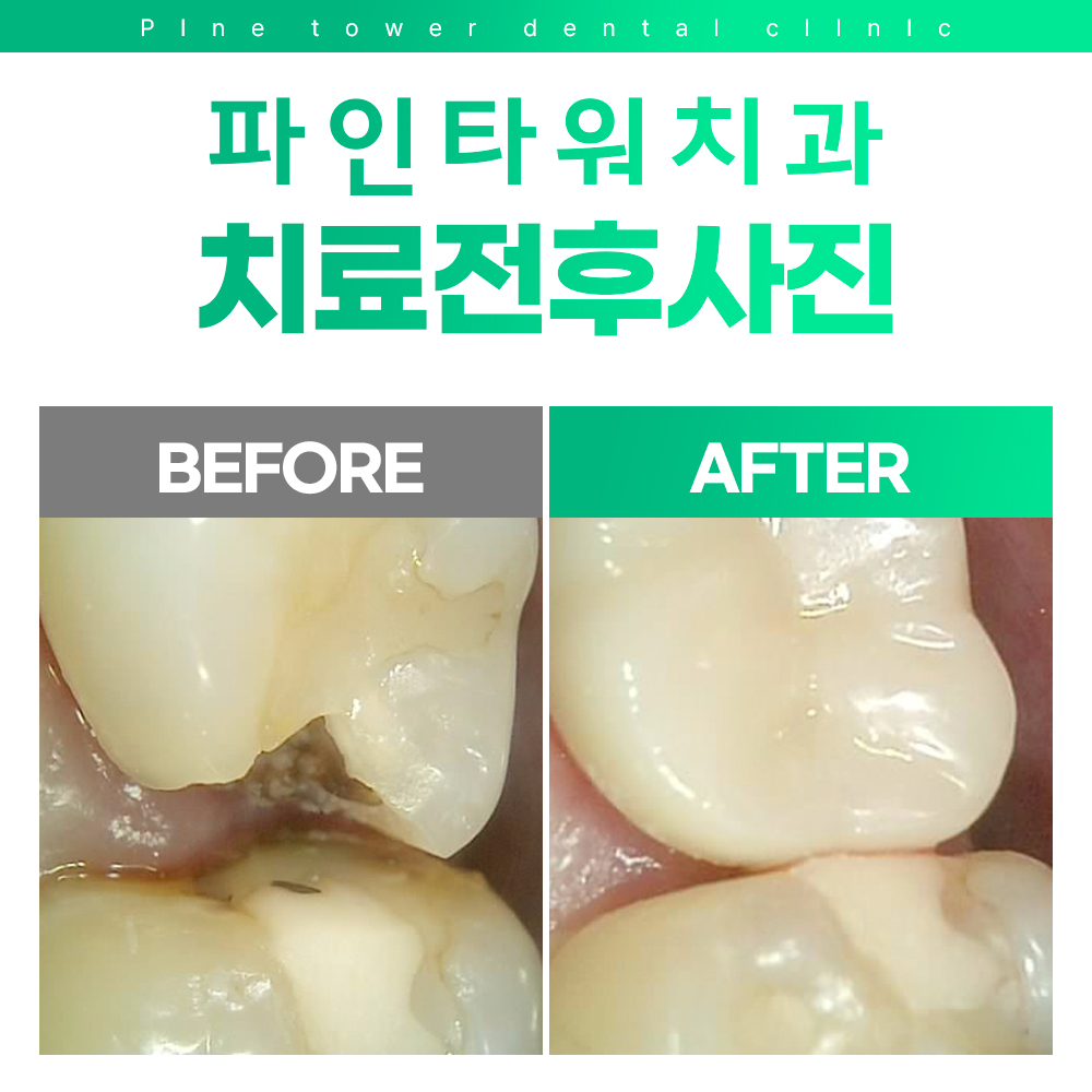 파인타워치과의원 대표 이미지
