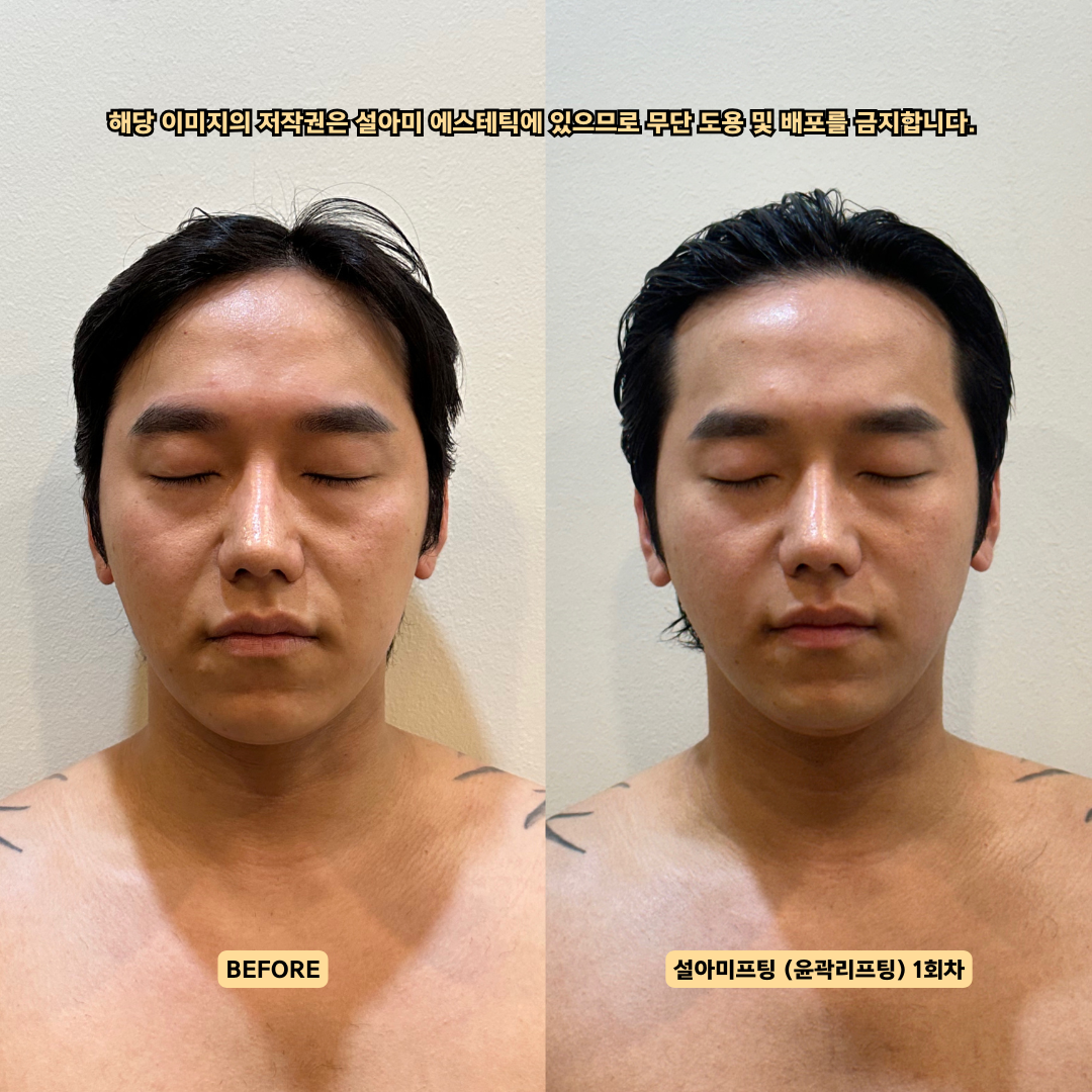 설아미 대표 이미지