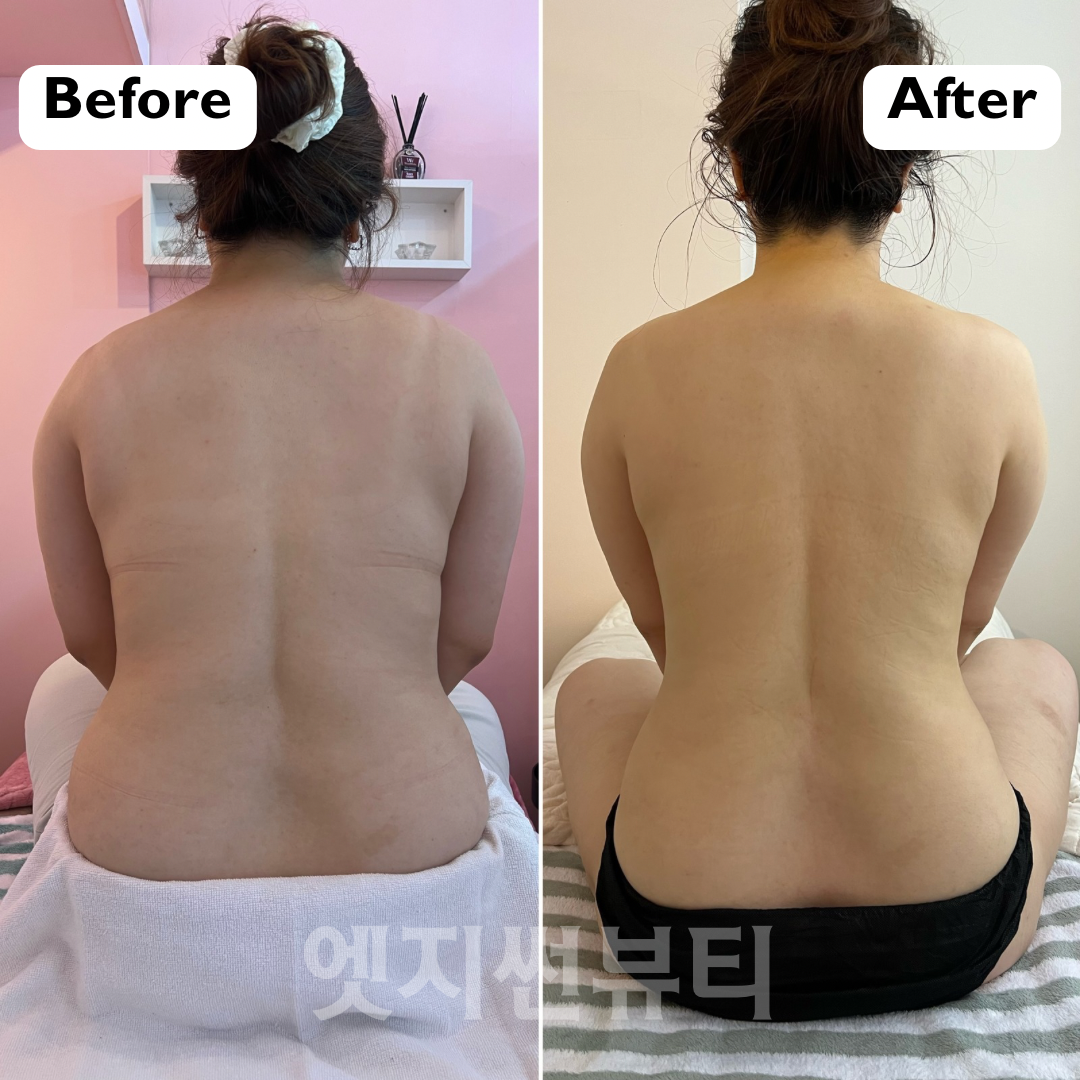 엣지썬뷰티 photo 6