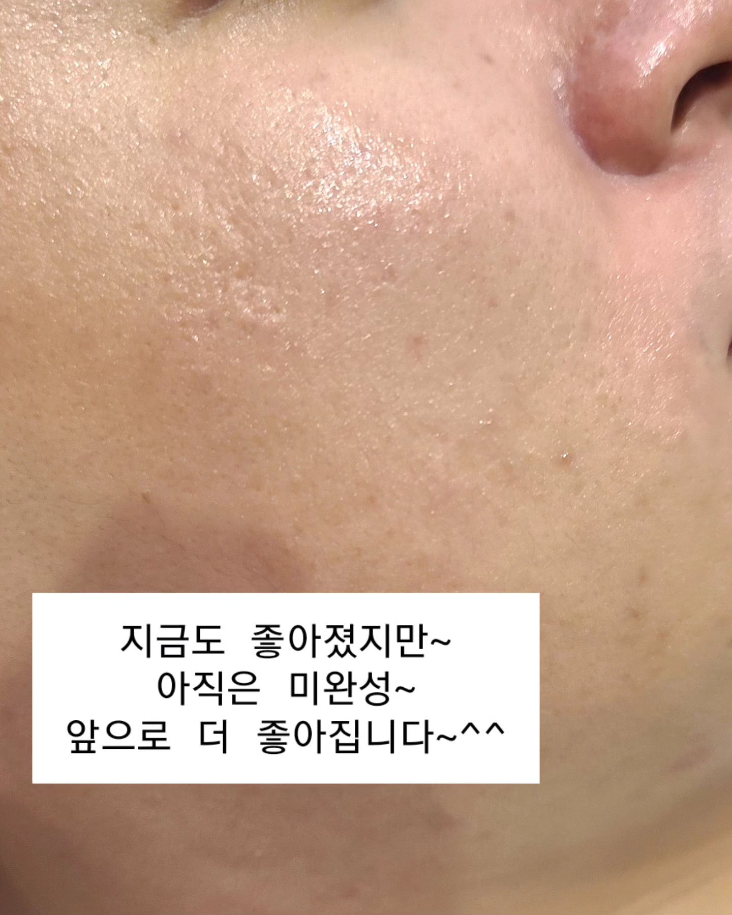 더마올가스킨