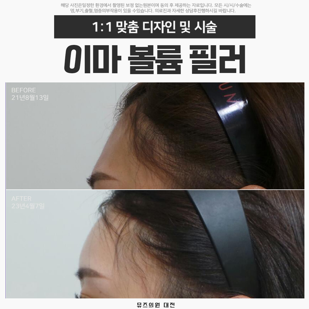 뮤즈의원 대전둔산 대표 이미지