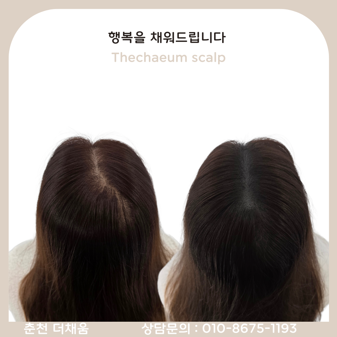 더채움 스칼프&뷰티
