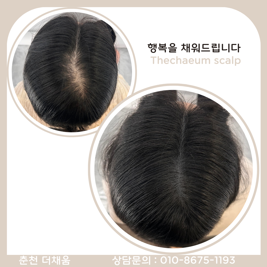 더채움 스칼프&뷰티