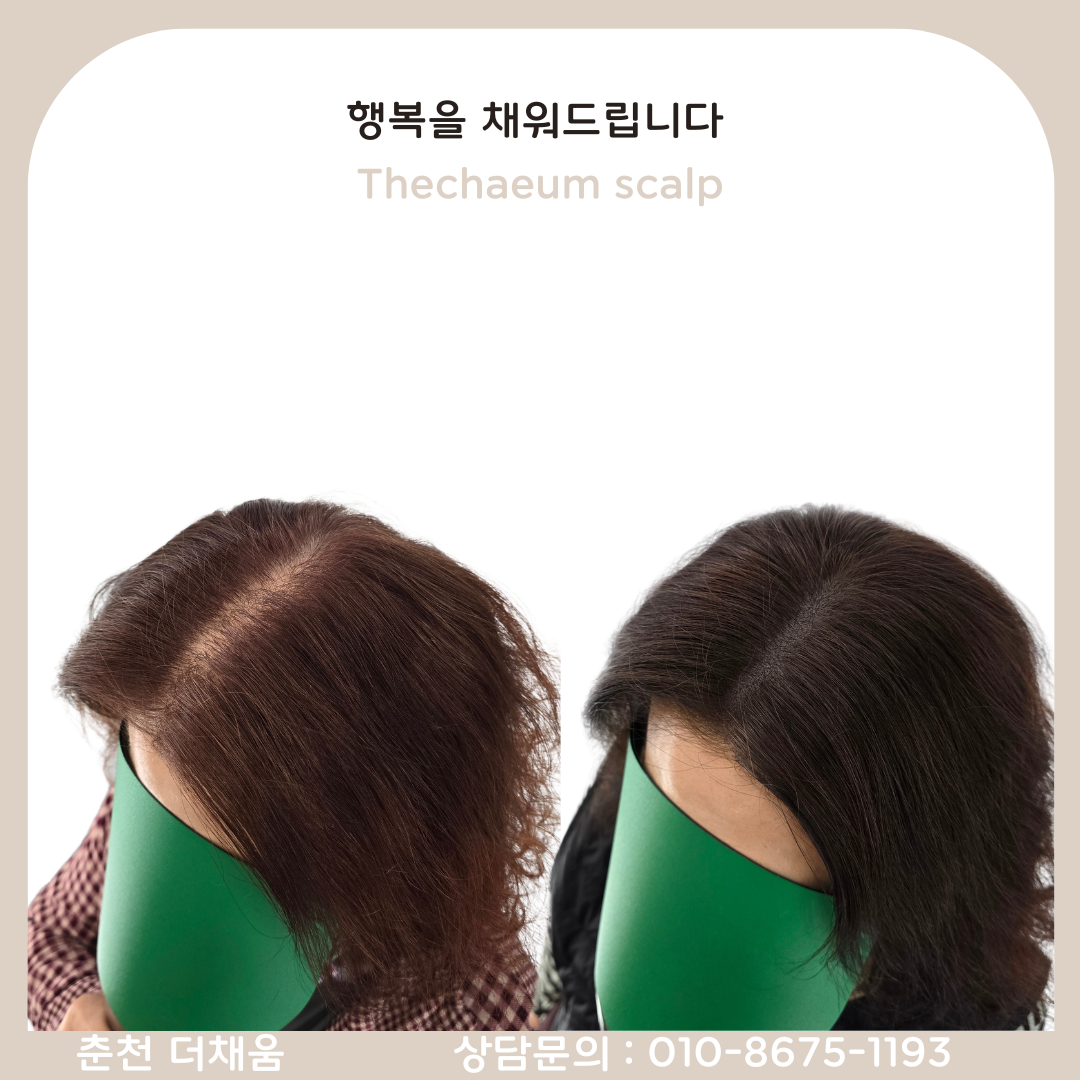 더채움 스칼프&뷰티