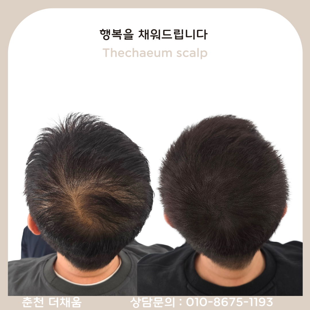 더채움 스칼프&뷰티