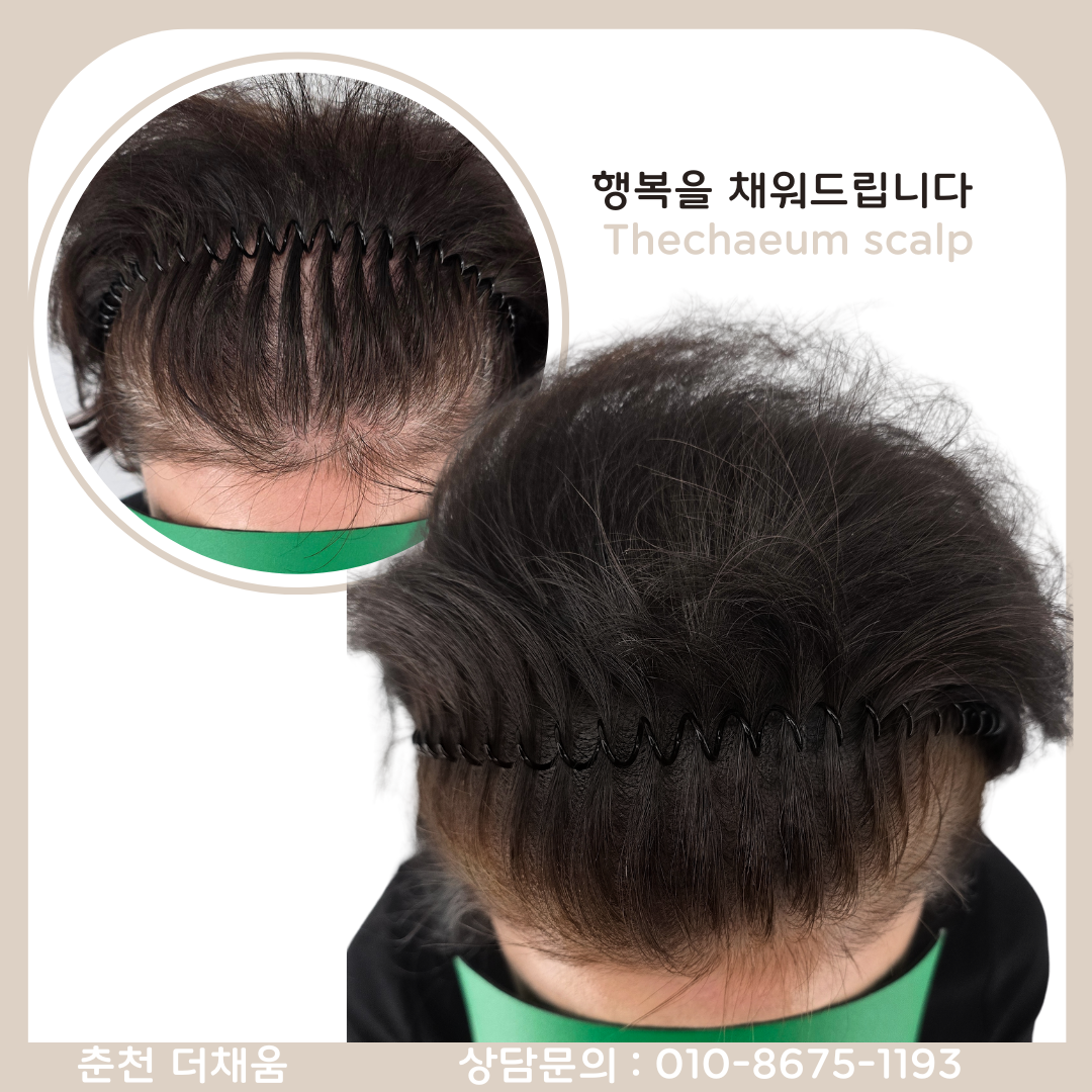 더채움 스칼프&뷰티