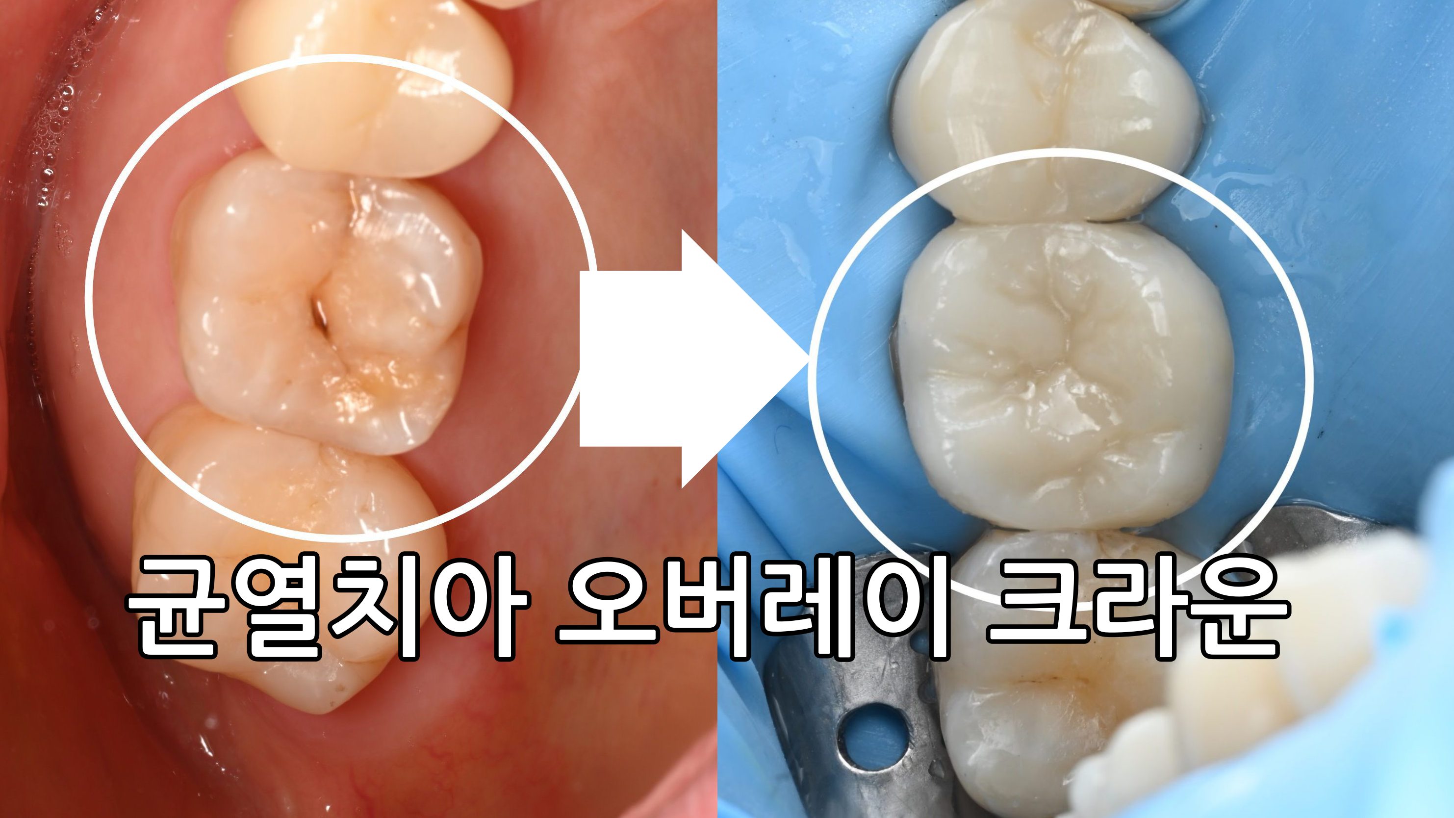 김동건바른치과의원 부평동암 대표 이미지