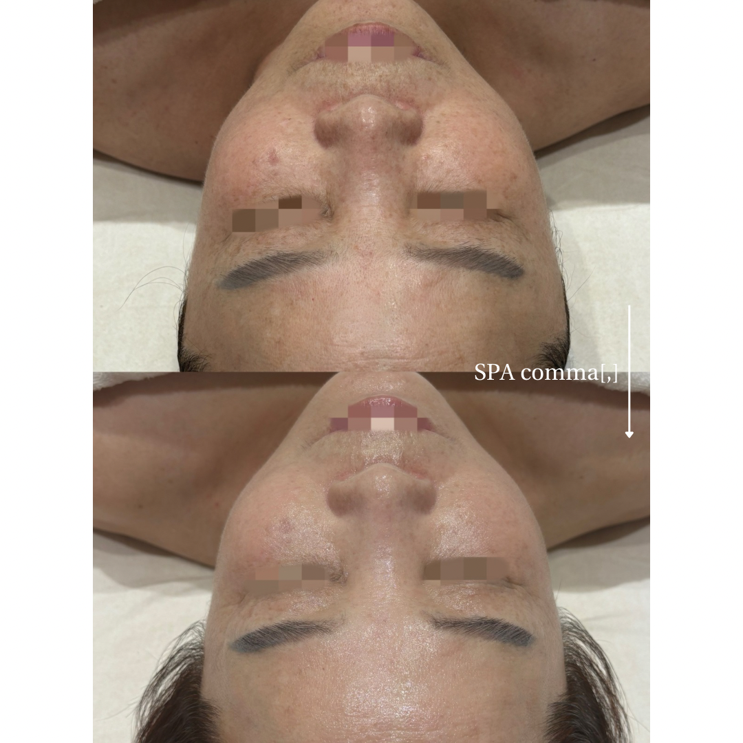 스파콤마 photo 3