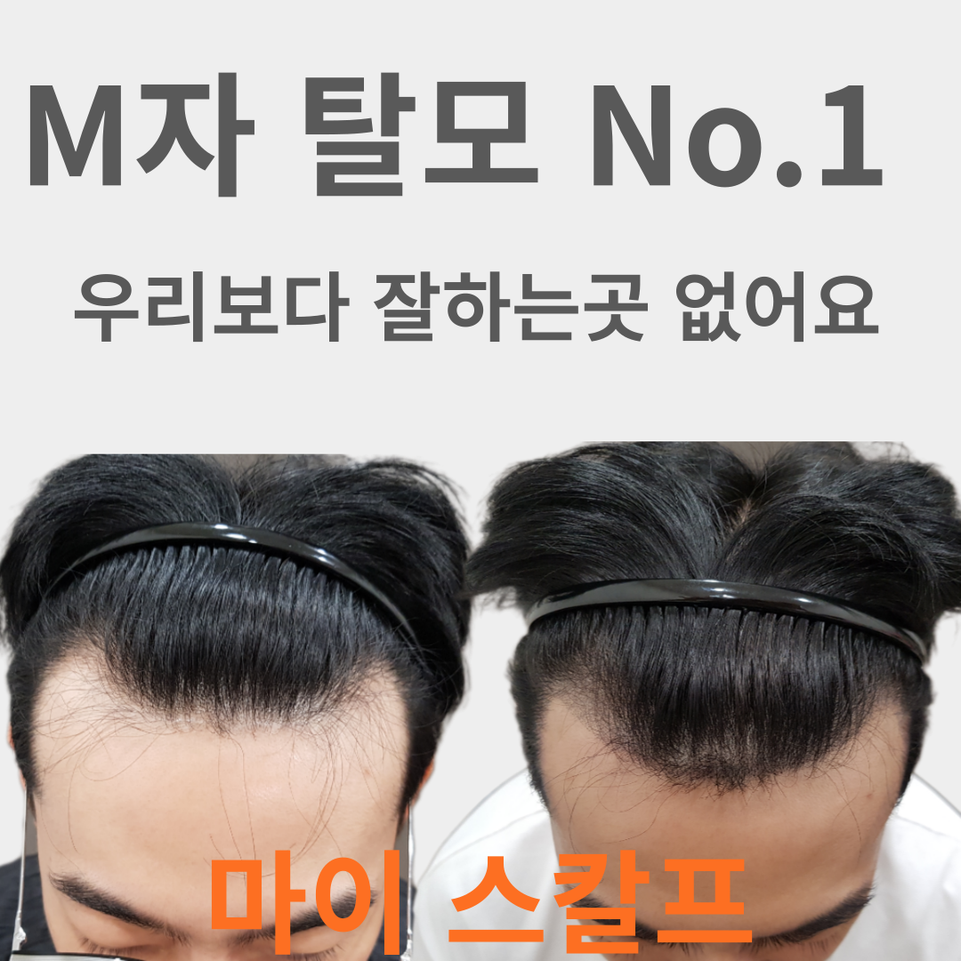 마이스칼프