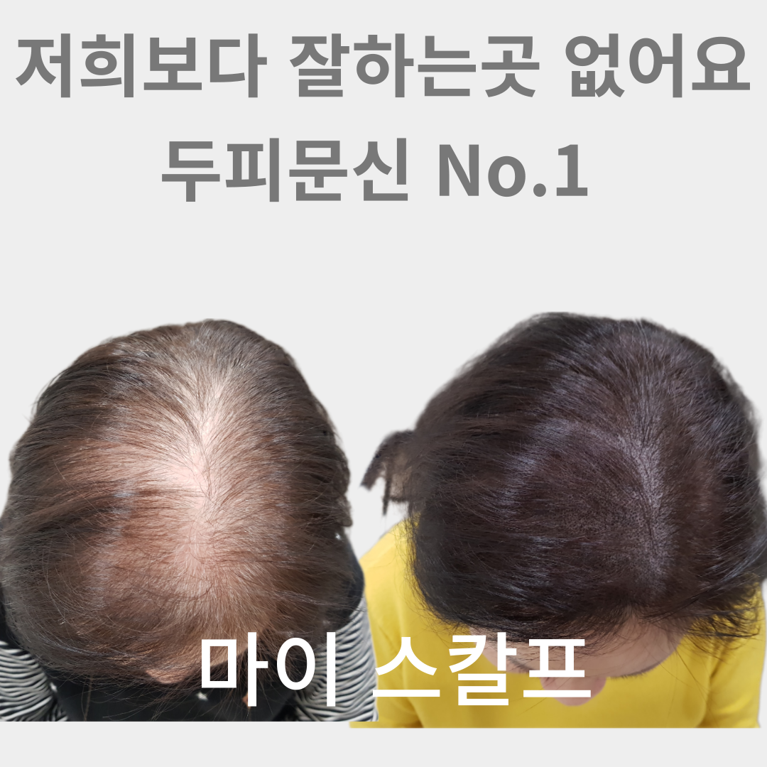 마이스칼프