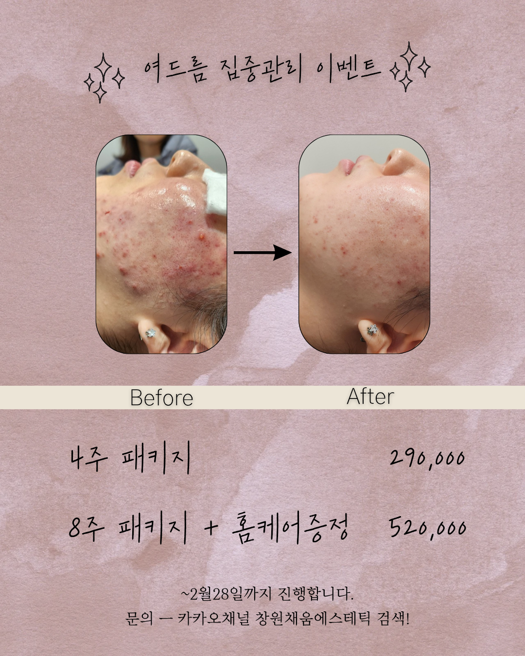 채움에스테틱