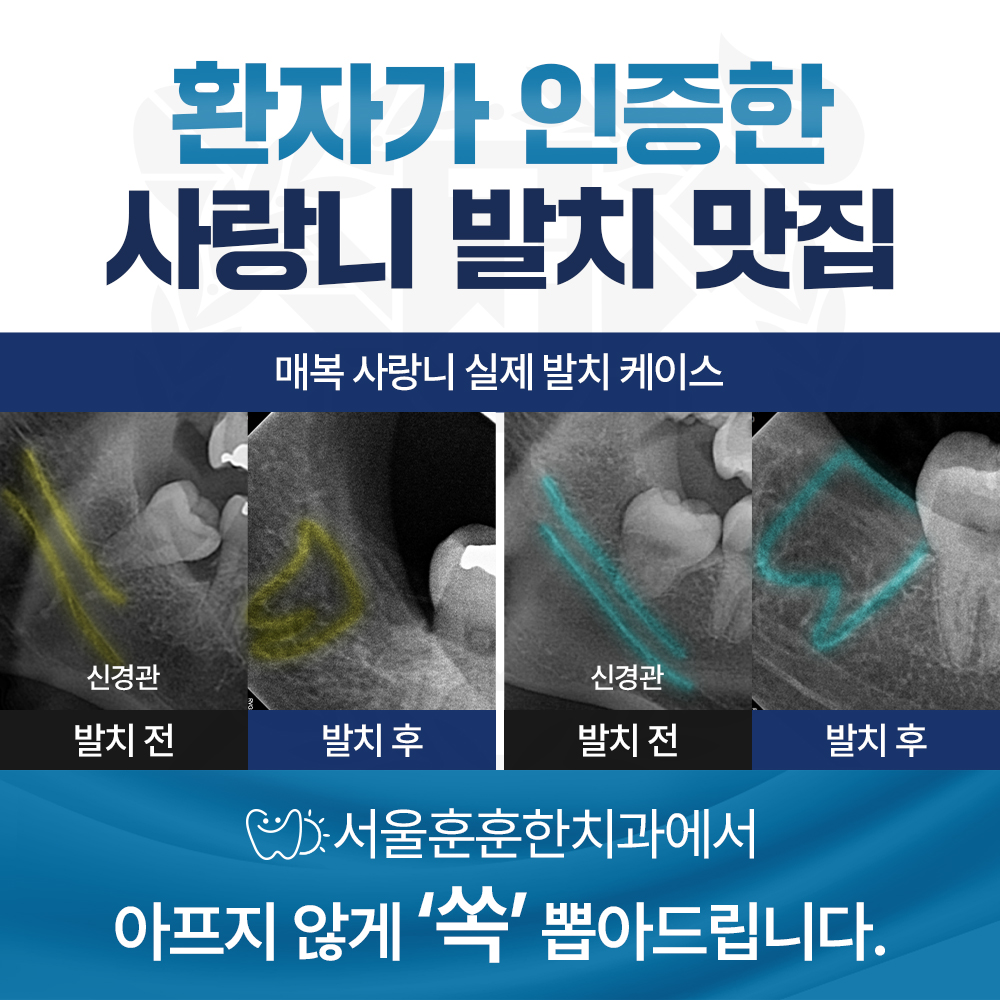 서울훈훈한치과의원 대표 이미지