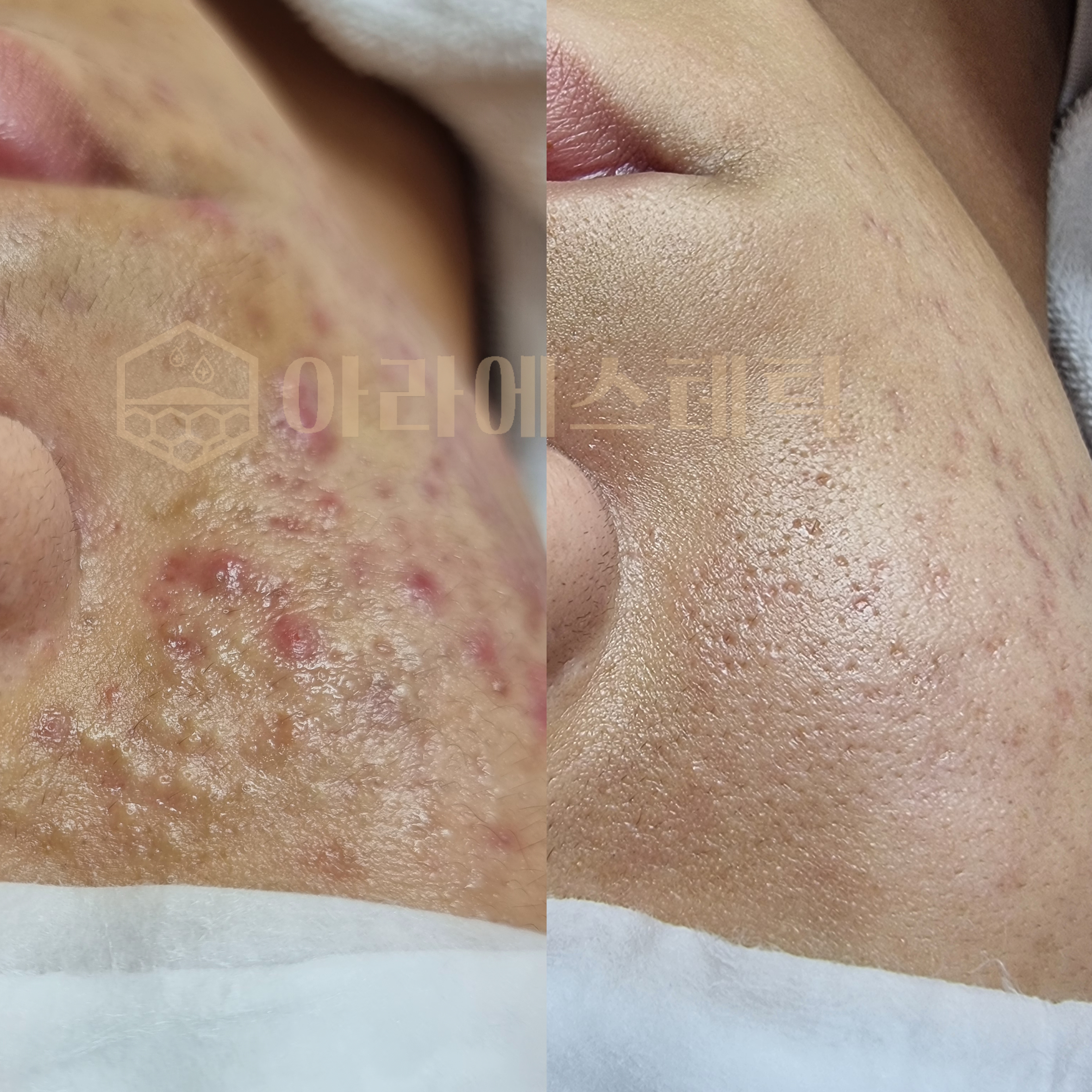 아라에스테틱 상모점 대표 이미지